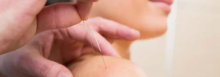 Dry Needling in Towson MD