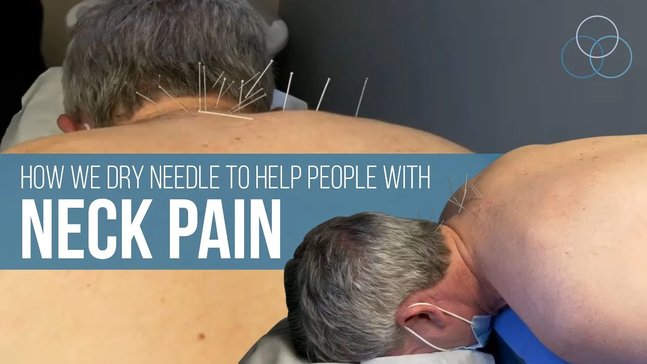 Chiropractic Towson MD Dry Needling Treatment