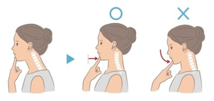 Chin Tucks exercise reference.